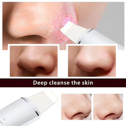 Ultrasonic Skin Scrubber & Blackhead Remover